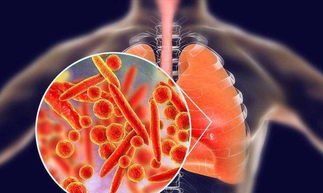 最新醫(yī)生感染情況及其影響，最新醫(yī)生感染情況及其社會影響分析